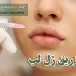 تزریق ژل لب
