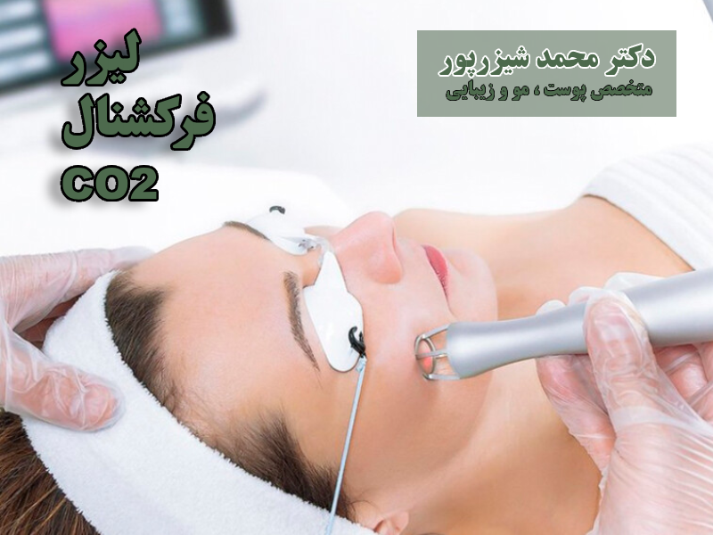 جوانسازی صورت با لیزر فرکشنال co2