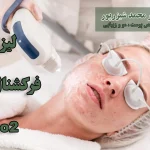 لیزر فرکشنال co2