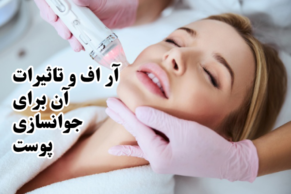 آر اف (RF) چیست؟