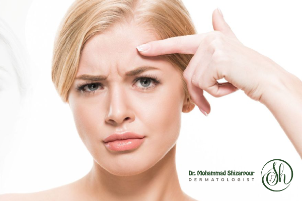 تزریق فیلر خط اخم چه کاربردی دارد؟
