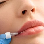 تزریق ژل فیلر-شاخص