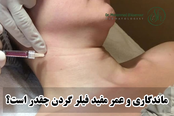 ماندگاری فیلر گردن