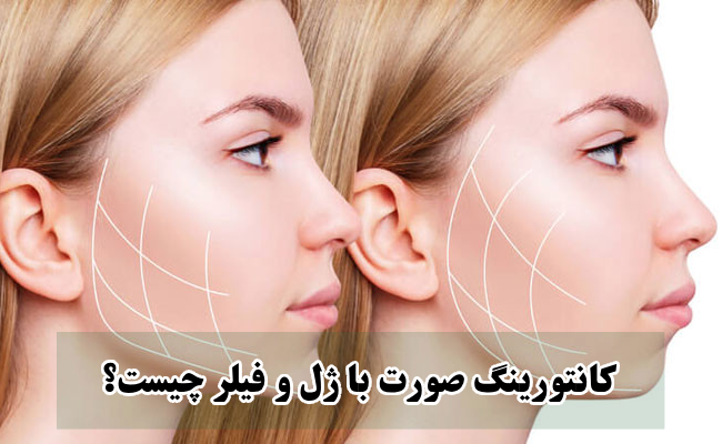 کانتورینگ صورت با ژل و فیلر چیست؟