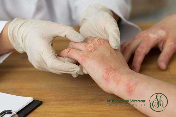 اهمیت مراجعه به بهترین متخصص پوست و مو