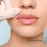تزریق ژل بعد از هایفوتراپی؛ تثبیت چهره‌ای جوان و شاداب!-شاخص