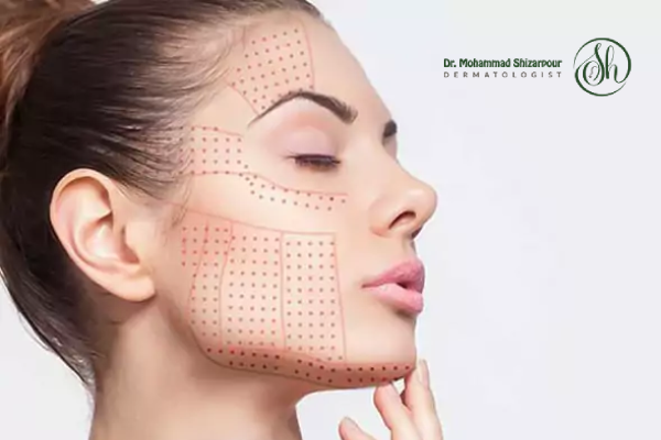 اهمیت مراقبت های بعد از هایفوتراپی