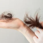 کنترل اختلال کشیدن مو