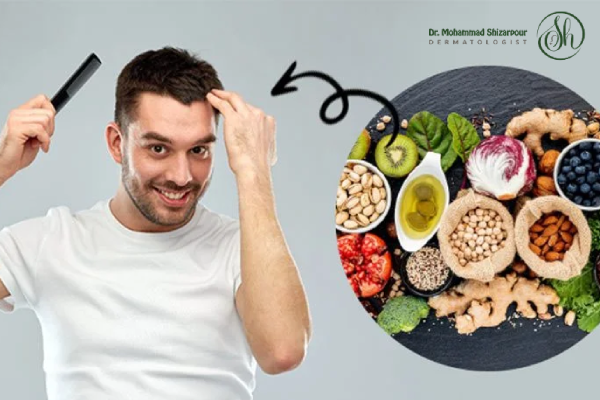 نقش سبک زندگی در درمان ریزش مو
