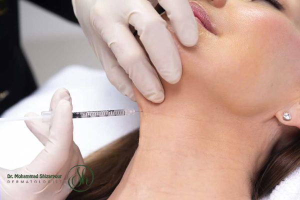 بوتاکس گردن چیست و چگونه عمل میکند؟