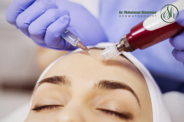 مراحل انجام مزوتراپی